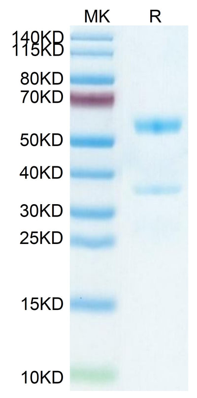 Mouse MFAP5 on Tris-Bis PAGE under reduced condition. The purity is greater than 95%.Recombinant Mouse MFAP5 Protein