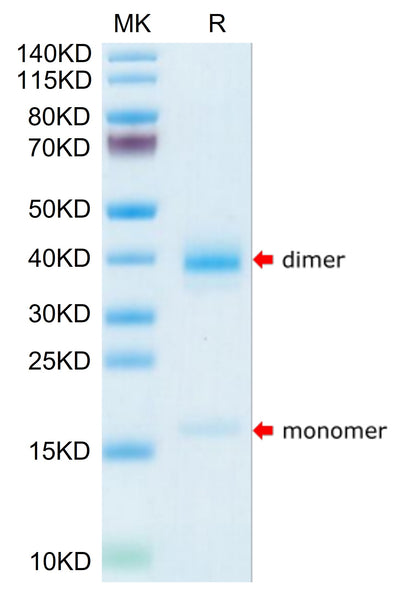 Human Transthyretin/Prealbumin on Tris-Bis PAGE under reduced condition. The purity is greater than 95%.Recombinant Human Transthyretin/Prealbumin Protein
