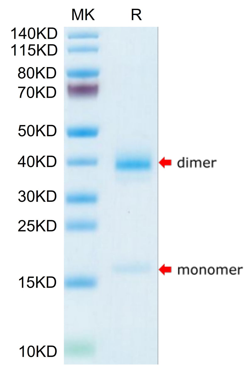 Human Transthyretin/Prealbumin on Tris-Bis PAGE under reduced condition. The purity is greater than 95%.Recombinant Human Transthyretin/Prealbumin Protein