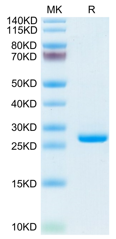 Mouse CRP on Tris-Bis PAGE under reduced condition. The purity is greater than 95%.Recombinant Mouse C-Reactive Protein/CRP Protein