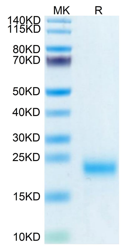 Human/Cynomolgus/Rhesus macaque ROR1 (165-305, Frizzled Domain) on Tris-Bis PAGE under reduced condition. The purity is greater than 95%.Recombinant Human/Cynomolgus/Rhesus macaque ROR1 (165-305, Frizzled Domain) Protein