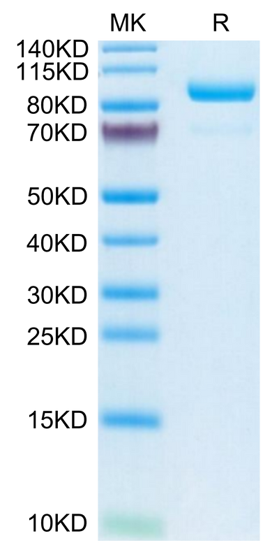 Human Complement Component C2 on Tris-Bis PAGE under reduced condition. The purity is greater than 95%.Recombinant Human Complement Component C2 Protein