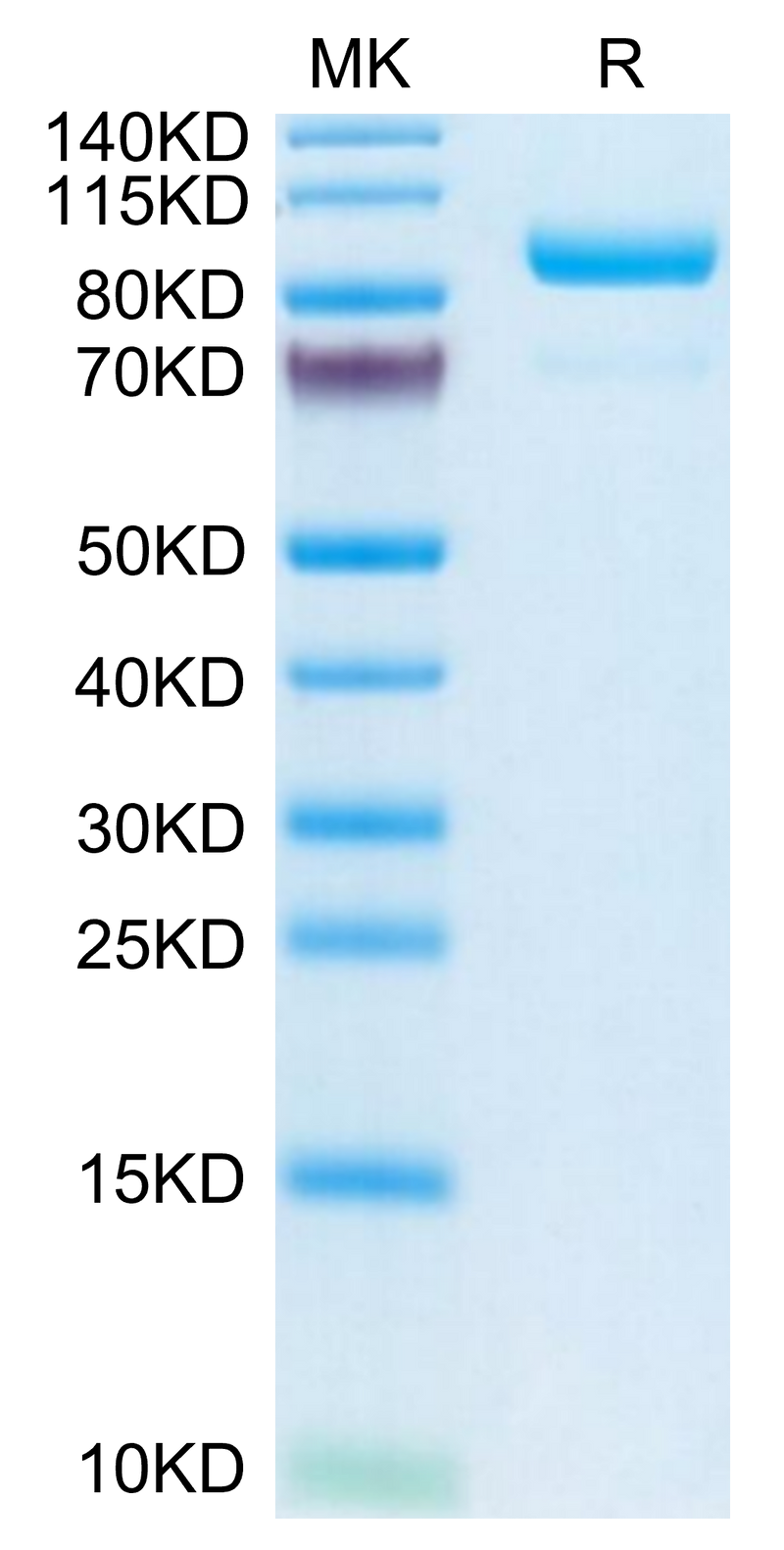 Human Complement Component C2 on Tris-Bis PAGE under reduced condition. The purity is greater than 95%.Recombinant Human Complement Component C2 Protein