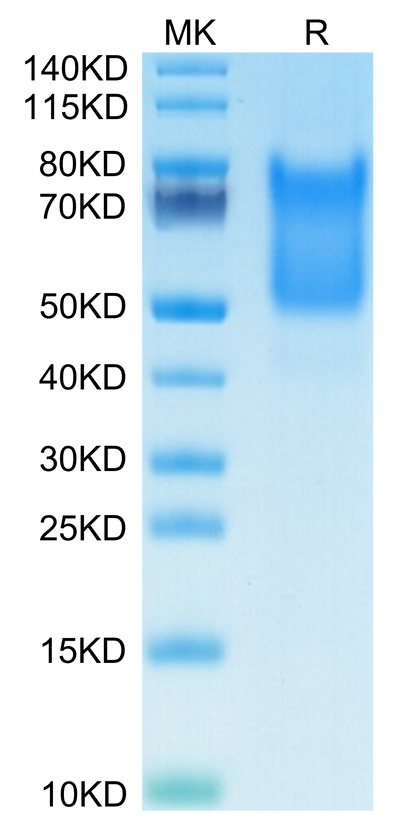 Human Syndecan-1 on Tris-Bis PAGE under reduced condition. The purity is greater than 95%.Recombinant Human Syndecan-1 Protein, Active