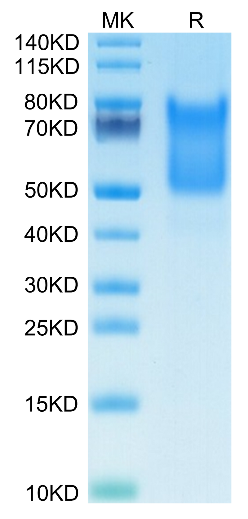 Human Syndecan-1 on Tris-Bis PAGE under reduced condition. The purity is greater than 95%.Recombinant Human Syndecan-1 Protein, Active
