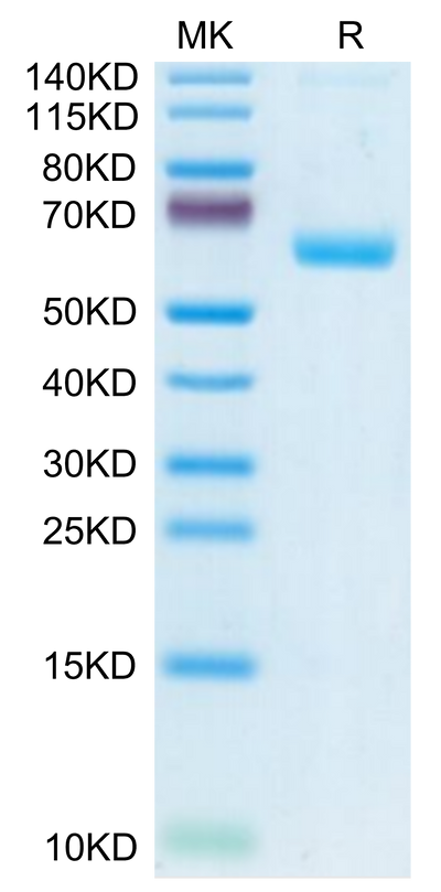 Human CLEC-1 on Tris-Bis PAGE under reduced condition. The purity is greater than 95%.Recombinant Human CLEC-1 Protein, Active
