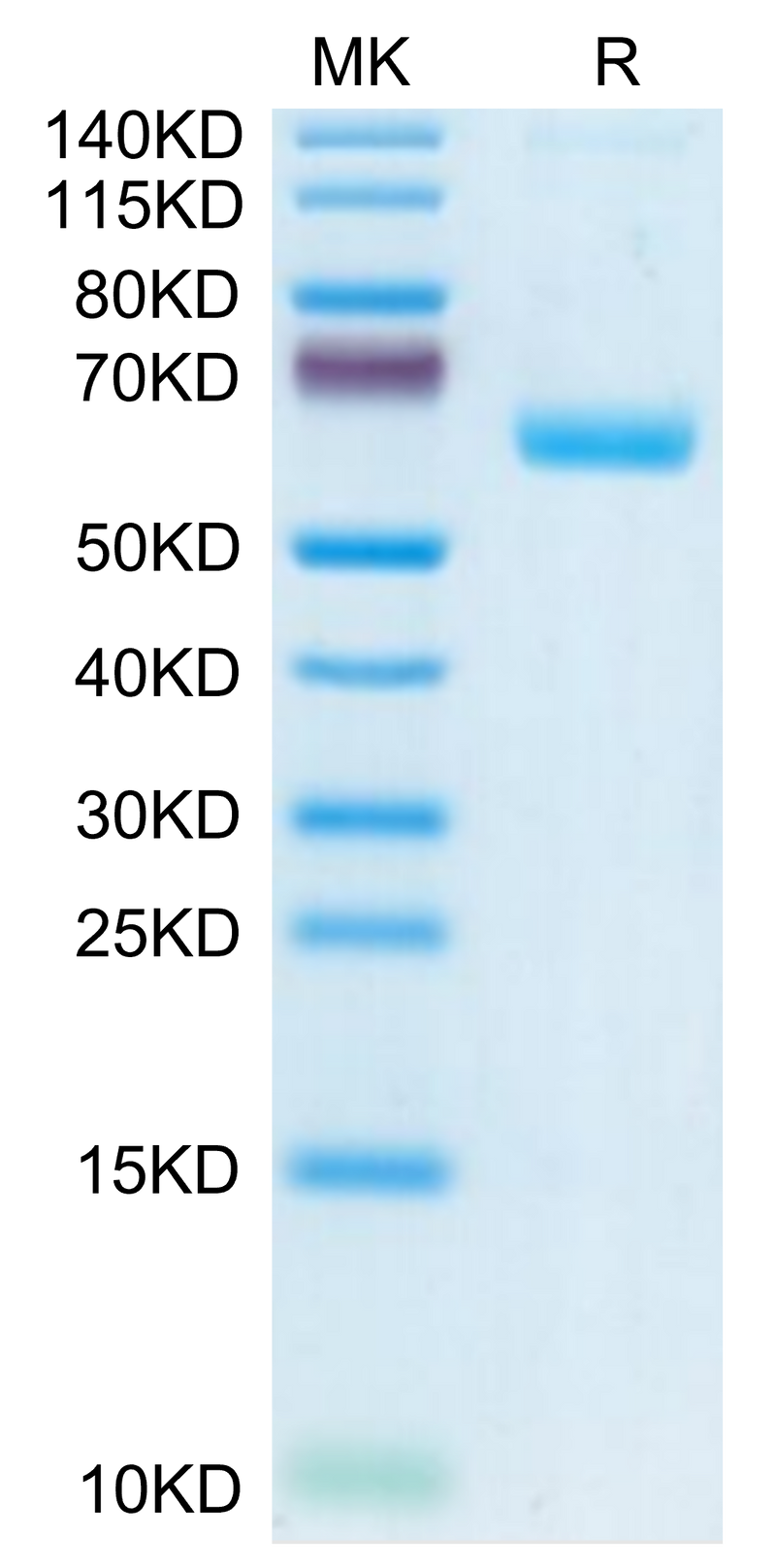 Human CLEC-1 on Tris-Bis PAGE under reduced condition. The purity is greater than 95%.Recombinant Human CLEC-1 Protein, Active