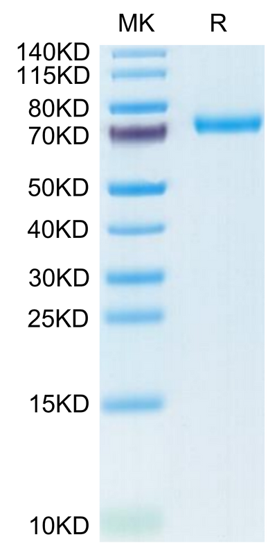Human DSG3 on Tris-Bis PAGE under reduced condition. The purity is greater than 95%.Recombinant Human DSG3 Protein, Active
