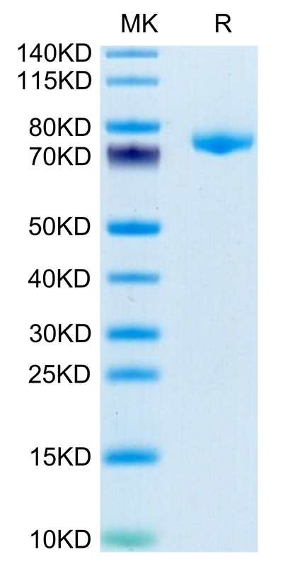 Mouse DSG3 on Tris-Bis PAGE under reduced condition. The purity is greater than 95%.Recombinant Mouse DSG3 Protein