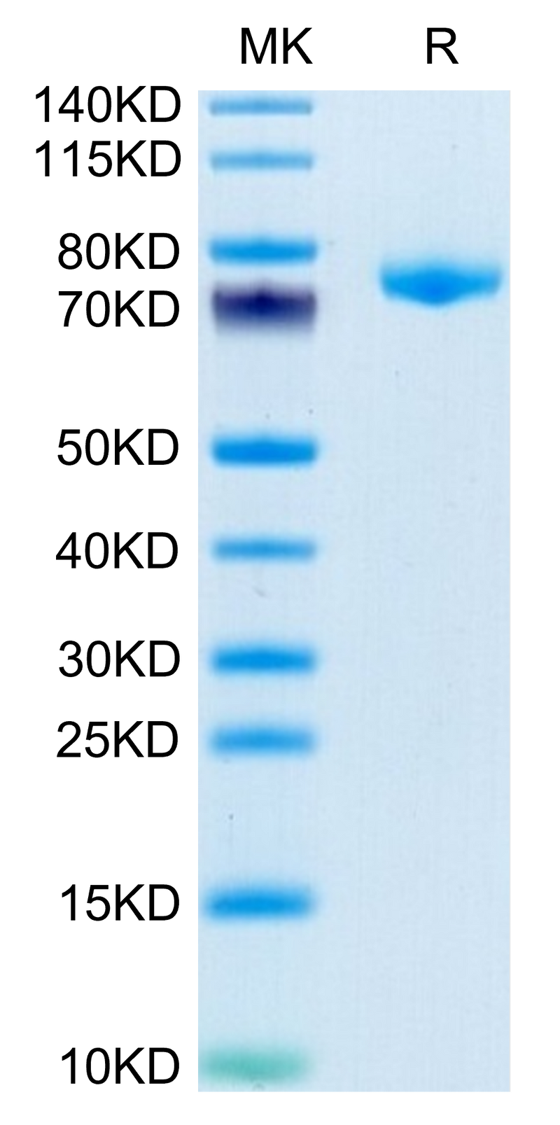 Mouse DSG3 on Tris-Bis PAGE under reduced condition. The purity is greater than 95%.Recombinant Mouse DSG3 Protein