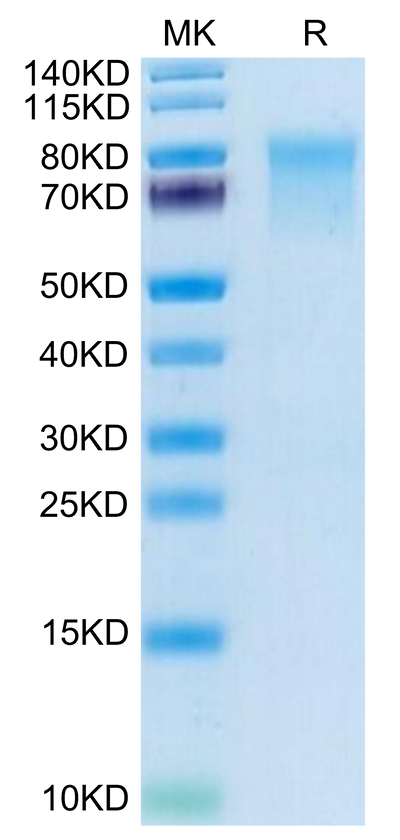 Mouse IL-15RA on Tris-Bis PAGE under reduced condition. The purity is greater than 95%.Recombinant Mouse IL-15RA/IL-15 R alpha/CD215 Protein, Active