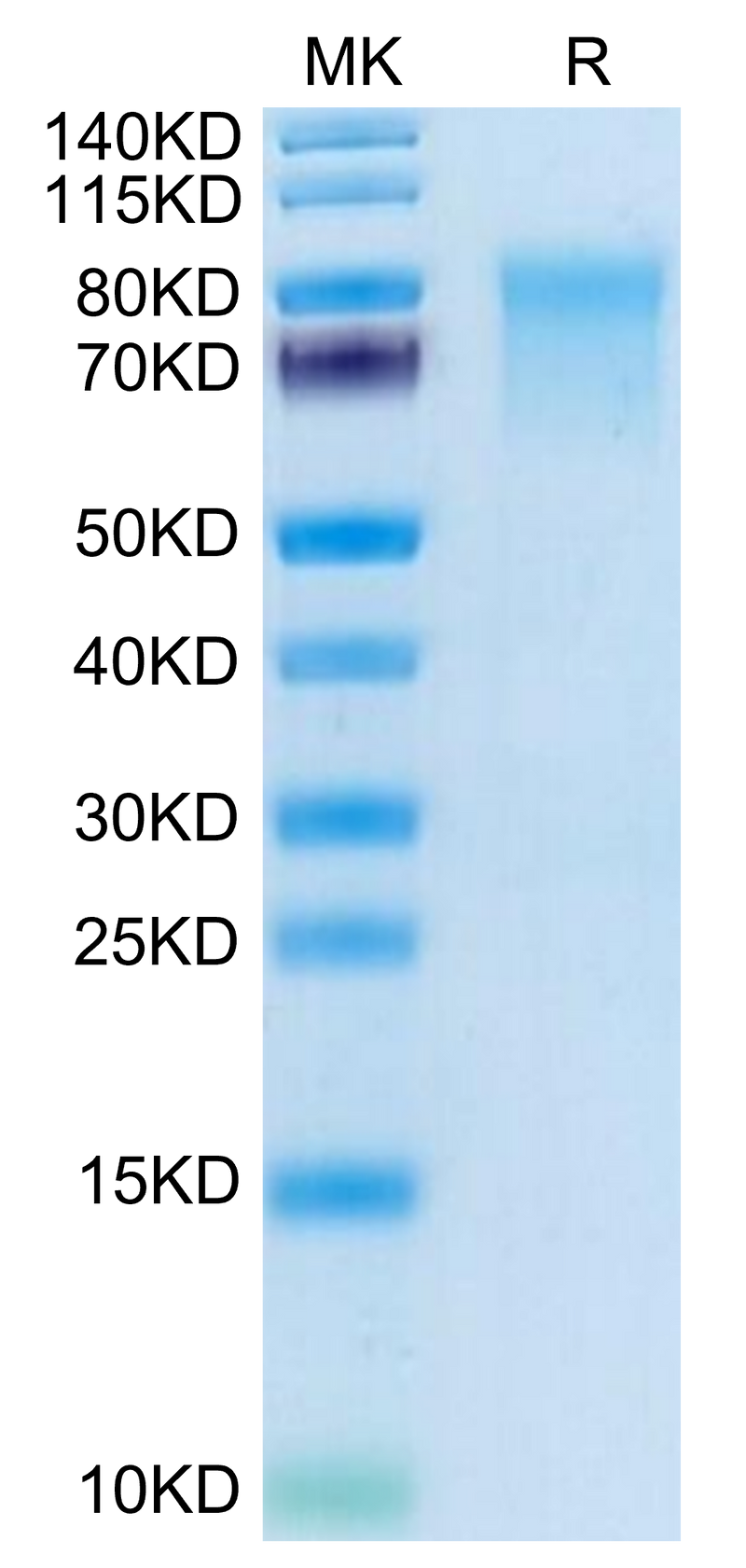 Mouse IL-15RA on Tris-Bis PAGE under reduced condition. The purity is greater than 95%.Recombinant Mouse IL-15RA/IL-15 R alpha/CD215 Protein, Active