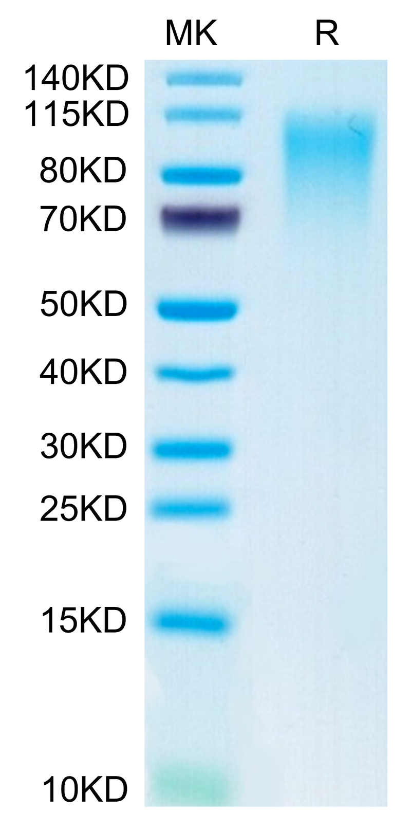 Mouse CD164 on Tris-Bis PAGE under reduced condition. The purity is greater than 95%.