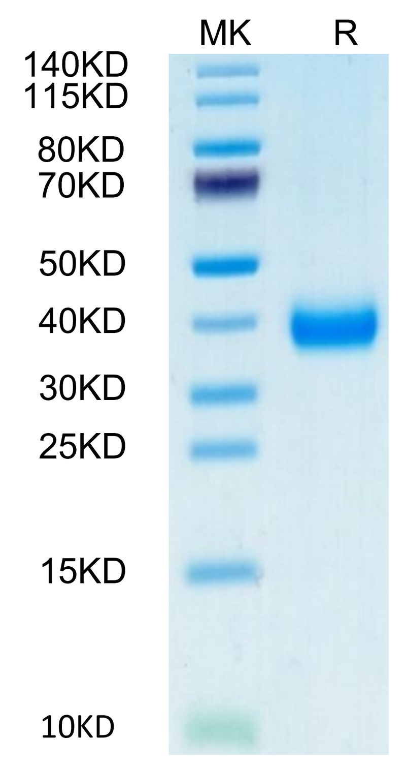 Biotinylated Cynomolgus CD161 on Tris-Bis PAGE under reduced condition. The purity is greater than 95%.Biotinylated Cynomolgus CD161 Protein, Active