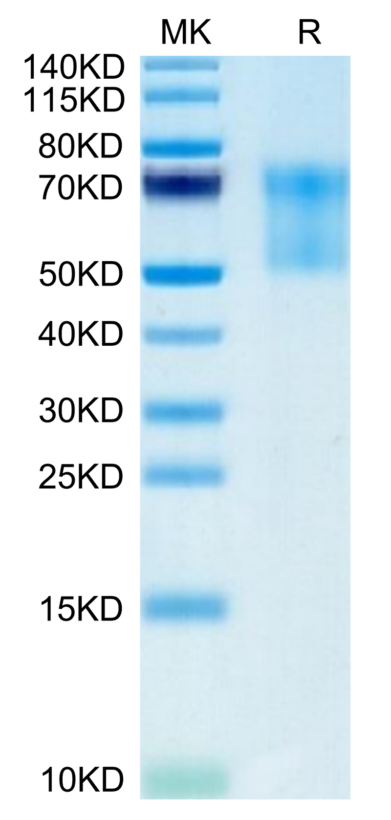Biotinylated Human Syndecan-1 on Tris-Bis PAGE under reduced condition. The purity is greater than 95%.Biotinylated Human Syndecan-1 Protein, Active