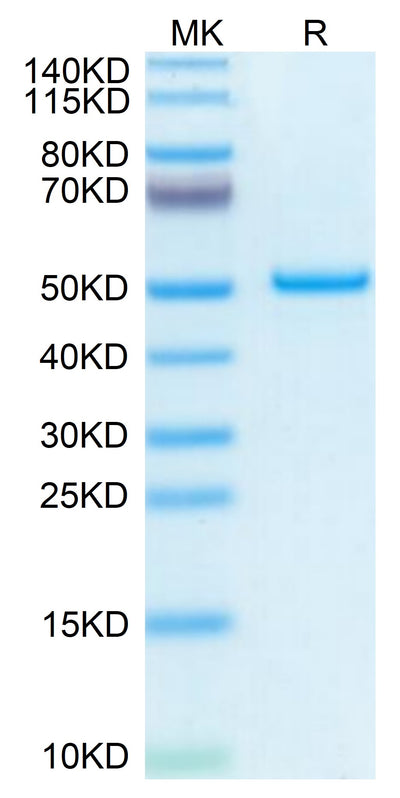 Mouse PTN on Tris-Bis PAGE under reduced condition. The purity is greater than 95%.Recombinant Mouse PTN Protein