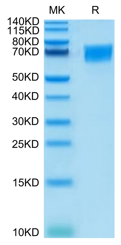Human CD58 on Tris-Bis PAGE under reduced condition. The purity is greater than 95%.Recombinant Human CD58 Protein, Active