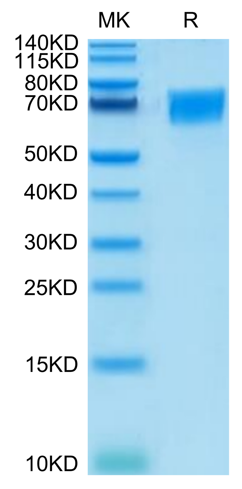 Human CD58 on Tris-Bis PAGE under reduced condition. The purity is greater than 95%.Recombinant Human CD58 Protein, Active