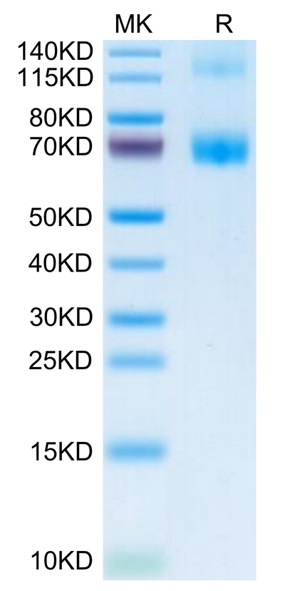 Mouse Fc Epsilon RI alpha/FCER1a on Tris-Bis PAGE under reduced condition. The purity is greater than 95%.Recombinant Mouse Fc Epsilon RI alpha/FCER1a Protein