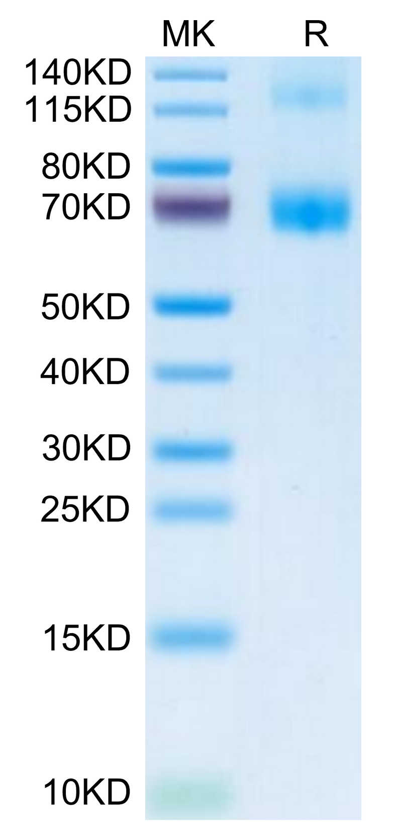 Mouse Fc Epsilon RI alpha/FCER1a on Tris-Bis PAGE under reduced condition. The purity is greater than 95%.