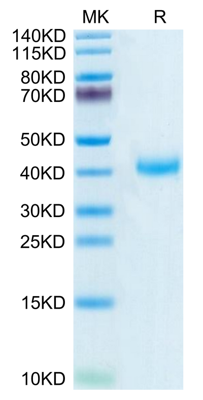 Biotinylated Human CD161 on Tris-Bis PAGE under reduced condition. The purity is greater than 95%.