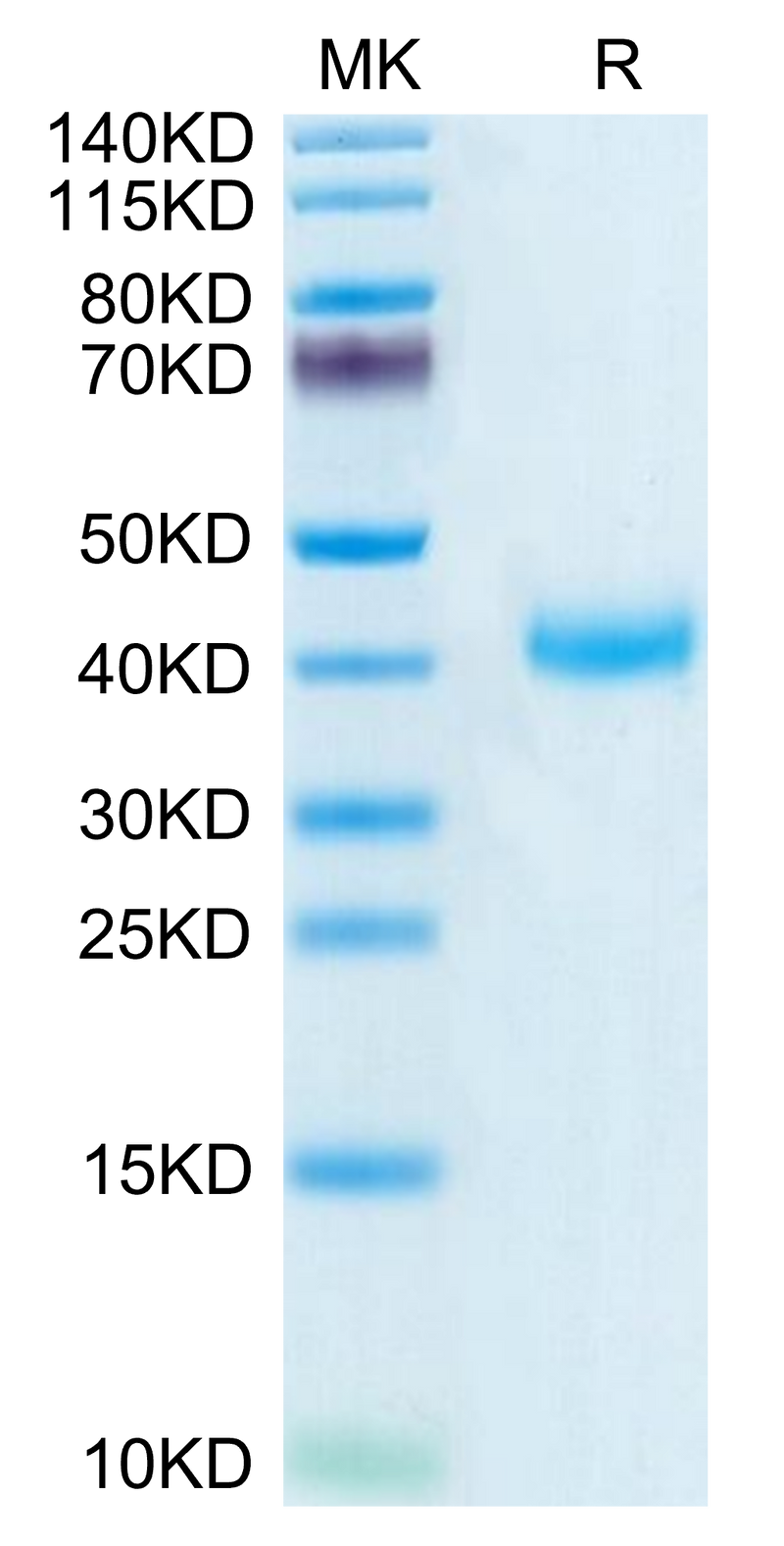 Biotinylated Human CD161 on Tris-Bis PAGE under reduced condition. The purity is greater than 95%.Biotinylated Human CD161 Protein, Active