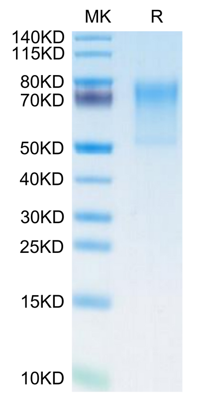Human ECSCR on Tris-Bis PAGE under reduced condition. The purity is greater than 95%.Recombinant Human ECSCR Protein
