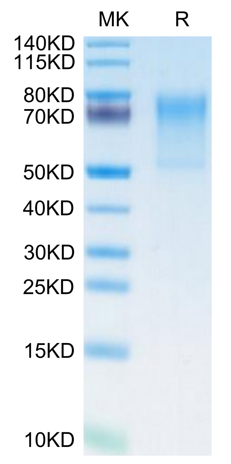Human ECSCR on Tris-Bis PAGE under reduced condition. The purity is greater than 95%.Recombinant Human ECSCR Protein