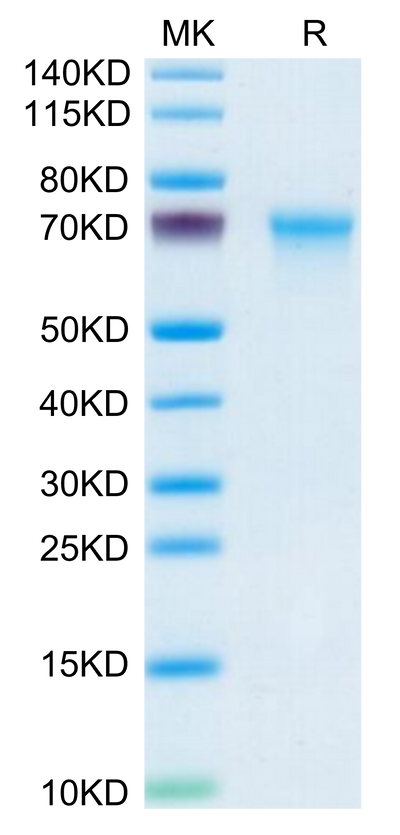 Mouse CXCL16 on Tris-Bis PAGE under reduced condition. The purity is greater than 95%.Recombinant Mouse CXCL16 Protein