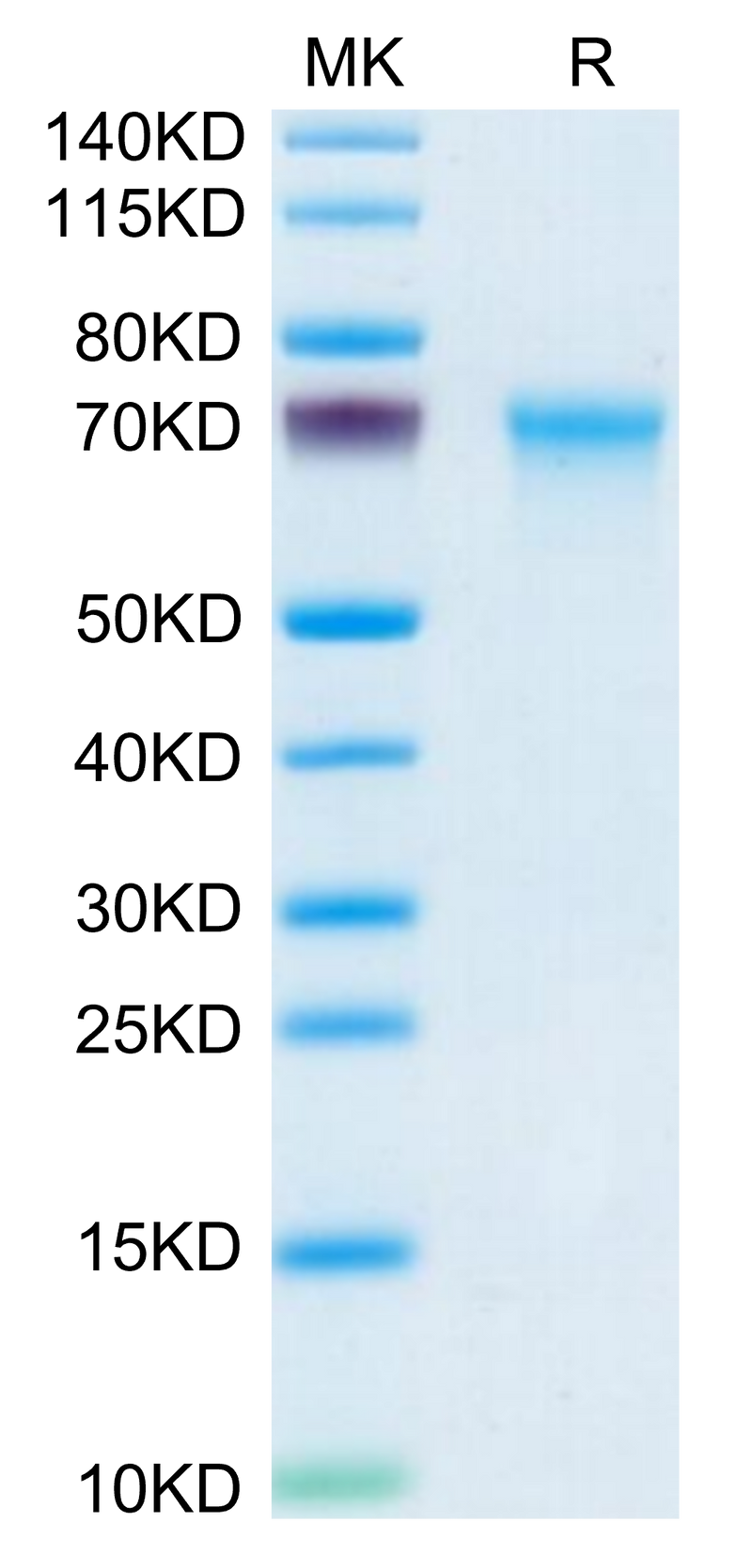Mouse CXCL16 on Tris-Bis PAGE under reduced condition. The purity is greater than 95%.Recombinant Mouse CXCL16 Protein
