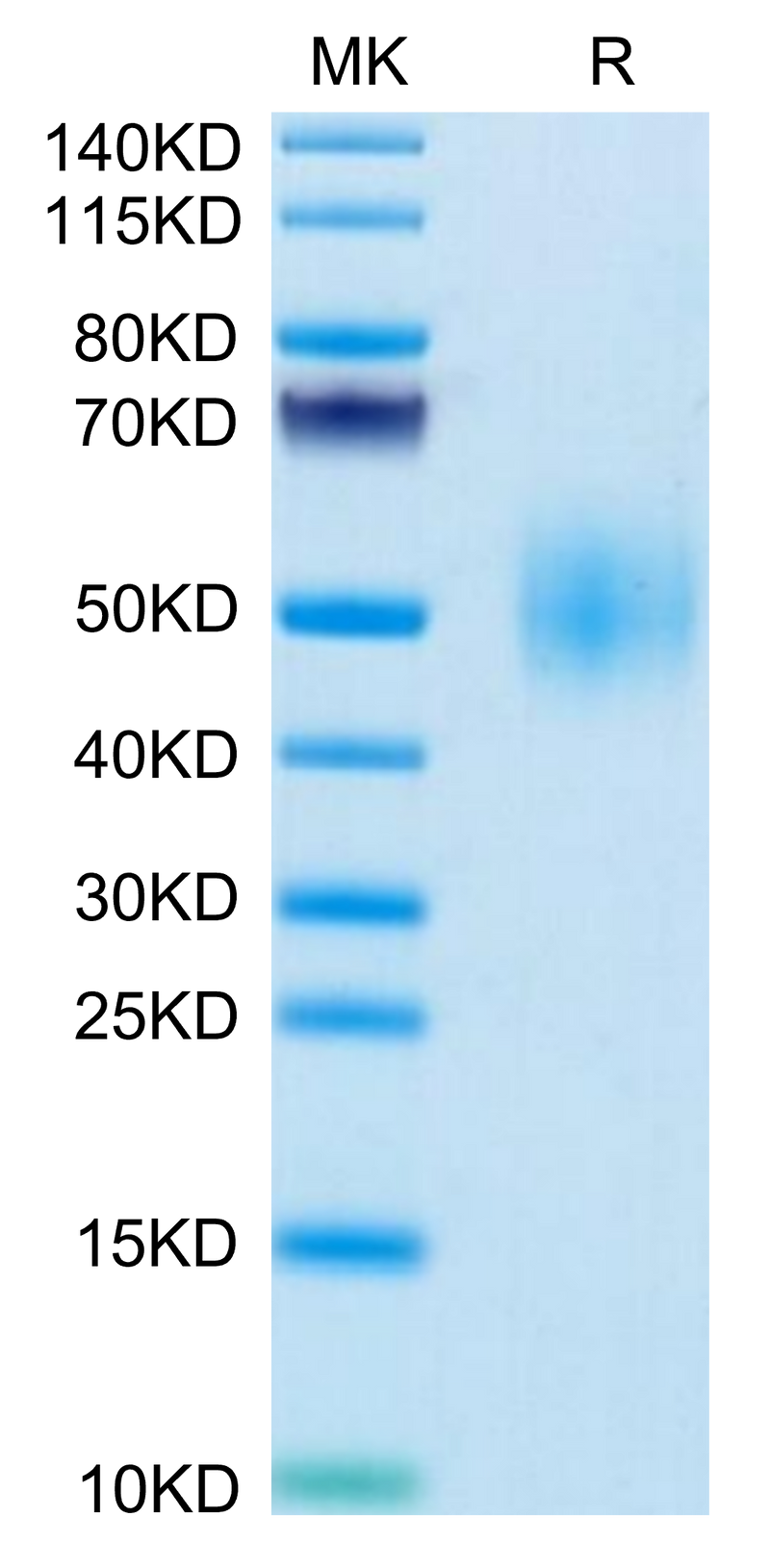 Mouse SLAMF1 on Tris-Bis PAGE under reduced condition. The purity is greater than 95%.Recombinant Mouse SLAMF1/SLAM/CD150 Protein