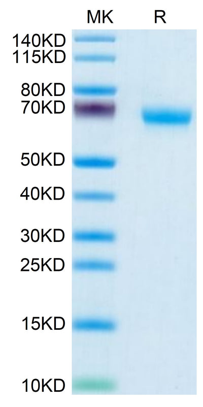 Human NKp46 on Tris-Bis PAGE under reduced condition. The purity is greater than 95%.Recombinant Human NKp46/NCR1/CD335 Protein, Active