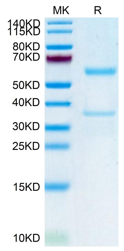 Human MFAP5 on Tris-Bis PAGE under reduced condition. The purity is greater than 95%.Recombinant Human MFAP5 Protein