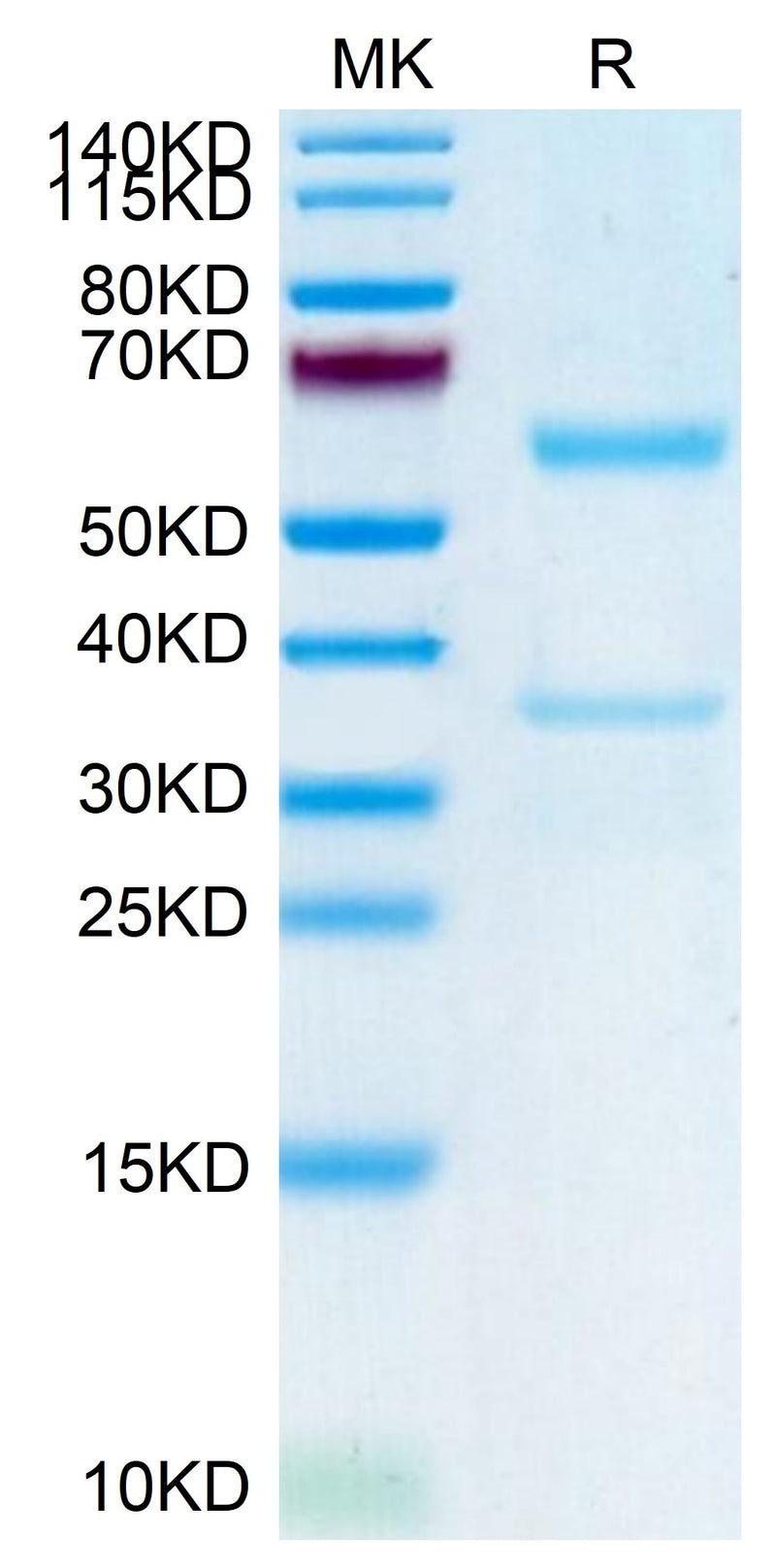 Human MFAP5 on Tris-Bis PAGE under reduced condition. The purity is greater than 95%.Recombinant Human MFAP5 Protein