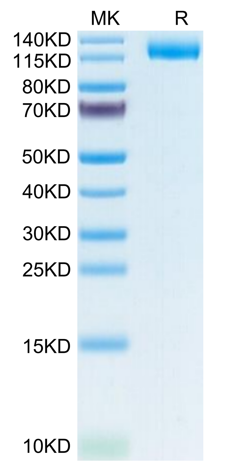 Human LIF R/CD118 on Tris-Bis PAGE under reduced condition. The purity is greater than 95%.Recombinant Human LIF R/CD118 Protein, Active
