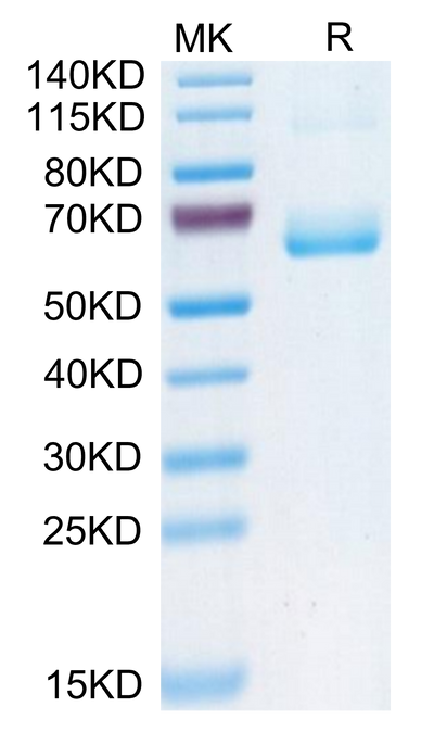 Human CD161 on Tris-Bis PAGE under reduced condition. The purity is greater than 95%.