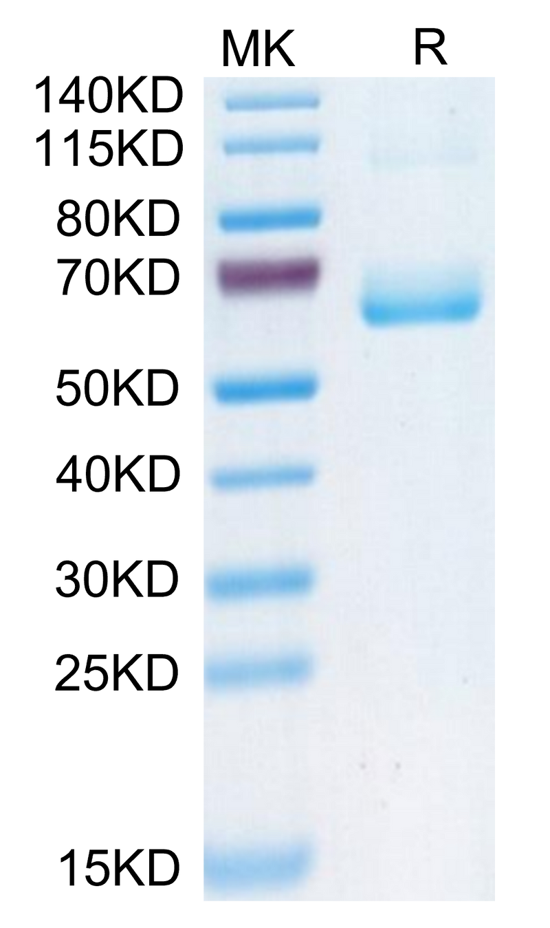 Human CD161 on Tris-Bis PAGE under reduced condition. The purity is greater than 95%.