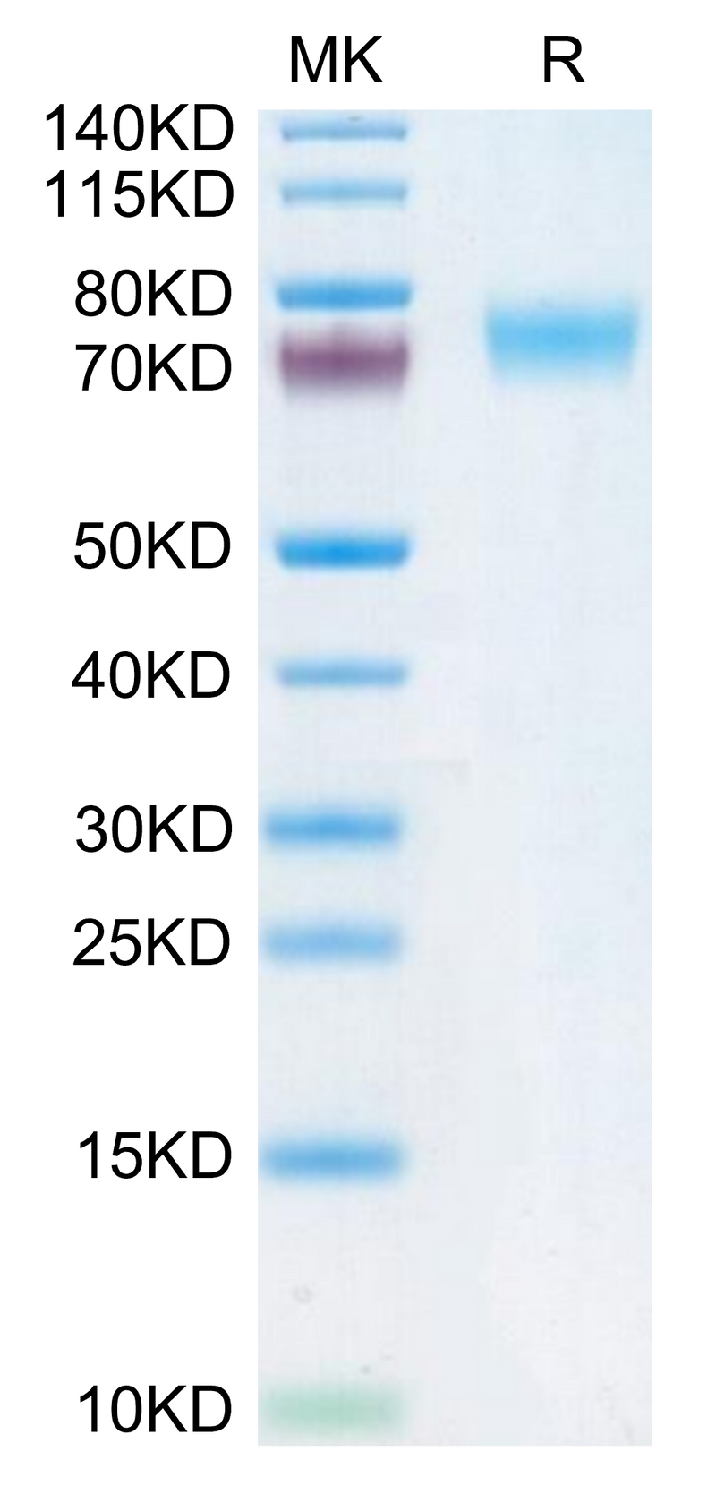 Human Fc epsilon RI alpha on Tris-Bis PAGE under reduced condition. The purity is greater than 95%.Recombinant Human Fc epsilon RI alpha/FCER1a Protein, Active