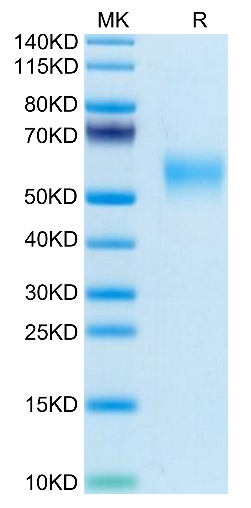 Mouse LOX1 on Tris-Bis PAGE under reduced condition. The purity is greater than 95%.Recombinant Mouse LOX1 Protein