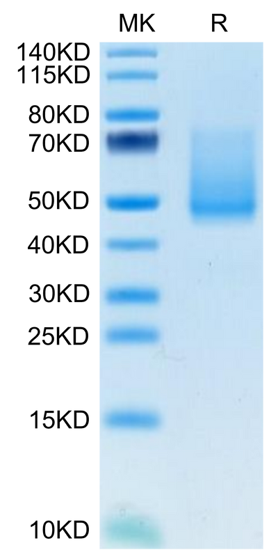 Mouse ECSCR on Tris-Bis PAGE under reduced condition. The purity is greater than 95%.Recombinant Mouse ECSCR Protein