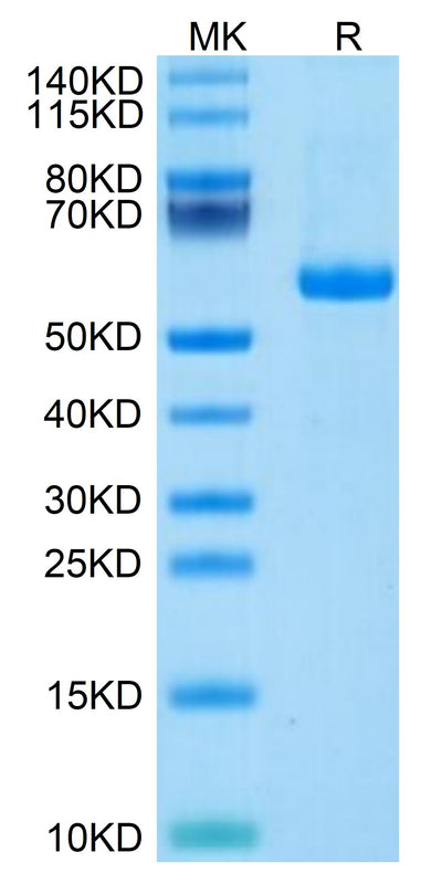 Human Notch 3 on Tris-Bis PAGE under reduced condition. The purity is greater than 95%.Recombinant Human Notch 3 Protein