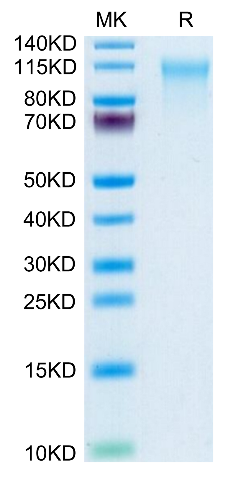 Human CD164 on Tris-Bis PAGE under reduced condition. The purity is greater than 95%.