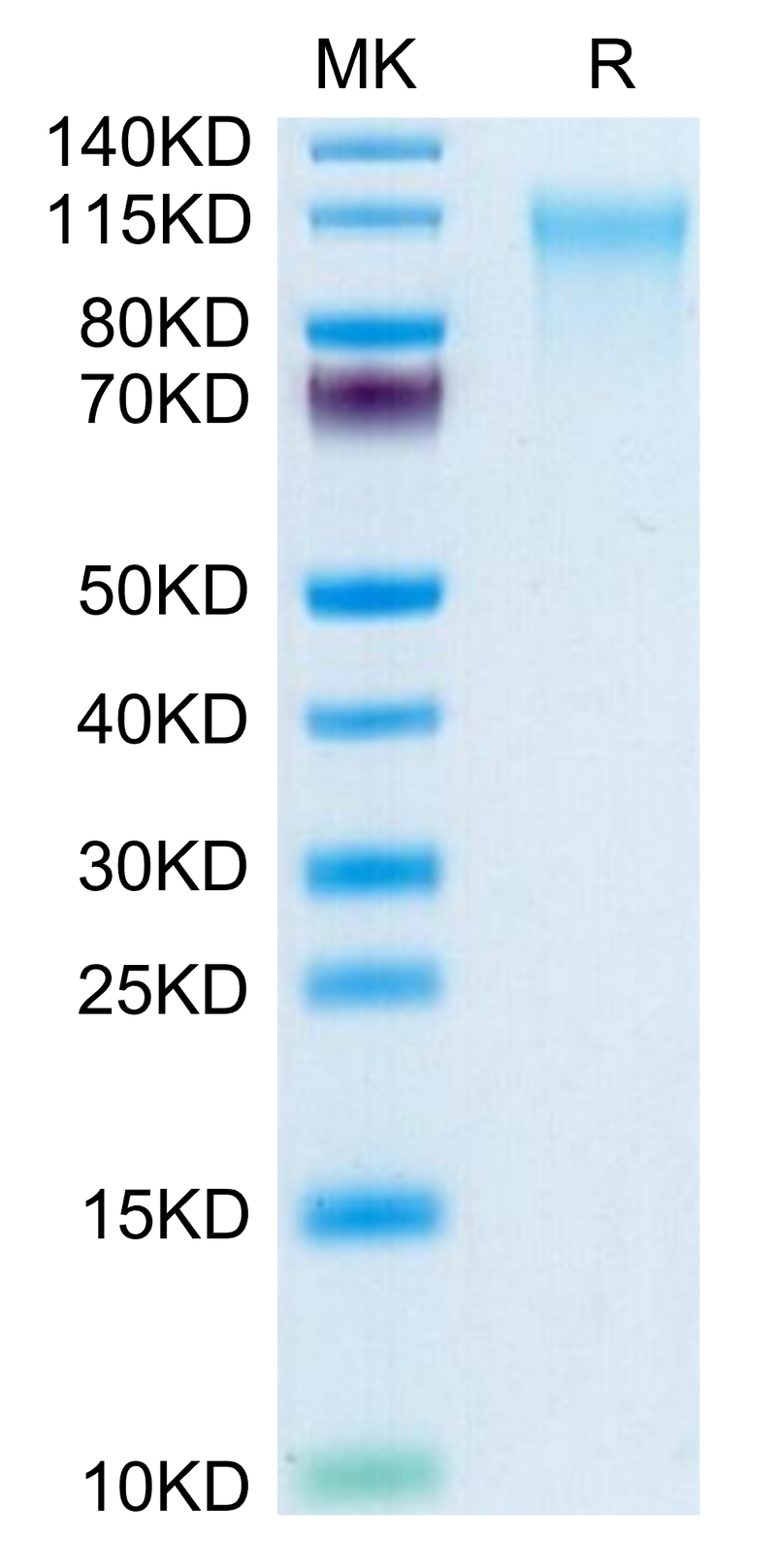 Human CD164 on Tris-Bis PAGE under reduced condition. The purity is greater than 95%.Recombinant Human CD164 Protein