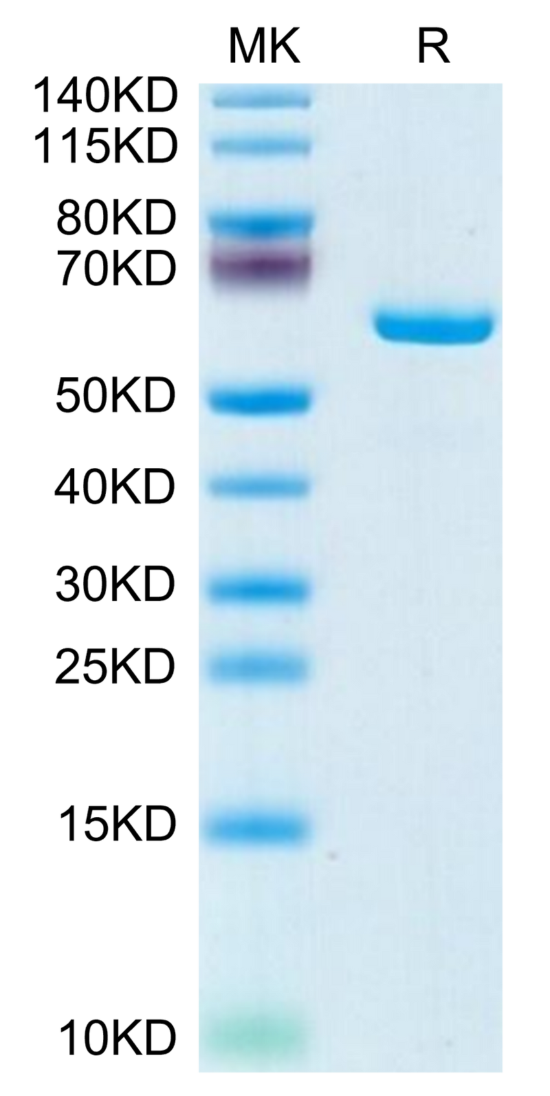 Mouse APOE on Tris-Bis PAGE under reduced condition. The purity is greater than 95%.Recombinant Mouse APOE/Apolipoprotein E Protein