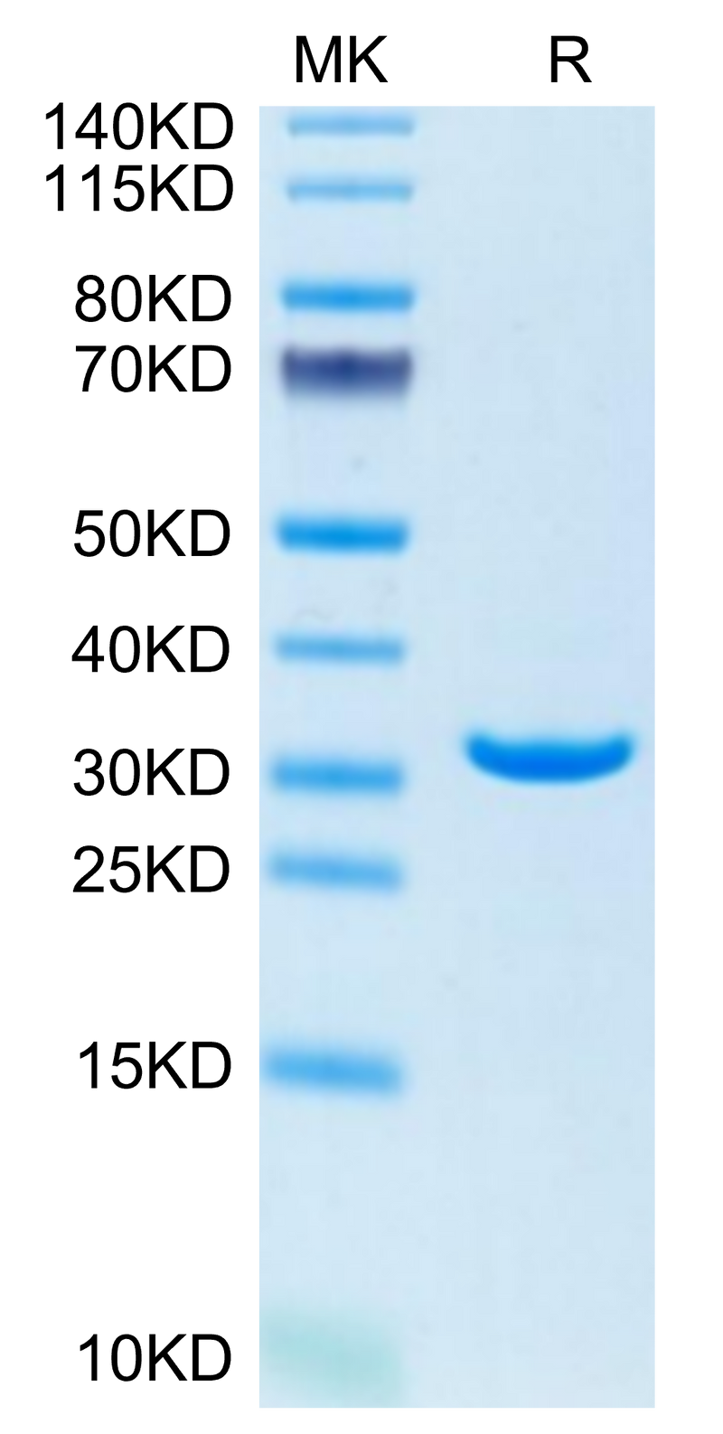 Human Annexin V/ANXA5 on Tris-Bis PAGE under reduced condition. The purity is greater than 95%.Recombinant Human Annexin V/ANXA5 Protein