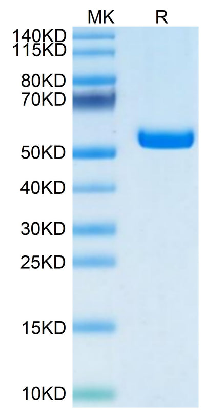 Human HLA-A*02:01&B2M&LMP2 (CLGGLLTMV) Monomer on Tris-Bis PAGE under reduced condition. The purity is greater than 95%.Recombinant Human HLA-A*02:01&B2M&LMP2 (CLGGLLTMV) Monomer Protein, Active