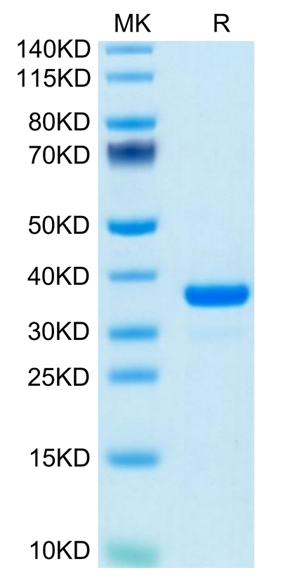 Mouse IGFBP-7 on Tris-Bis PAGE under reduced condition. The purity is greater than 95%.Recombinant Mouse IGFBP-7 Protein
