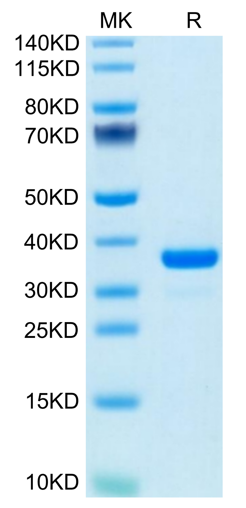 Mouse IGFBP-7 on Tris-Bis PAGE under reduced condition. The purity is greater than 95%.Recombinant Mouse IGFBP-7 Protein