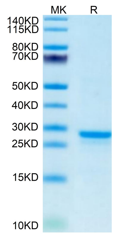 Mouse PS20 on Tris-Bis PAGE under reduced condition. The purity is greater than 95%.Recombinant Mouse PS20 Protein