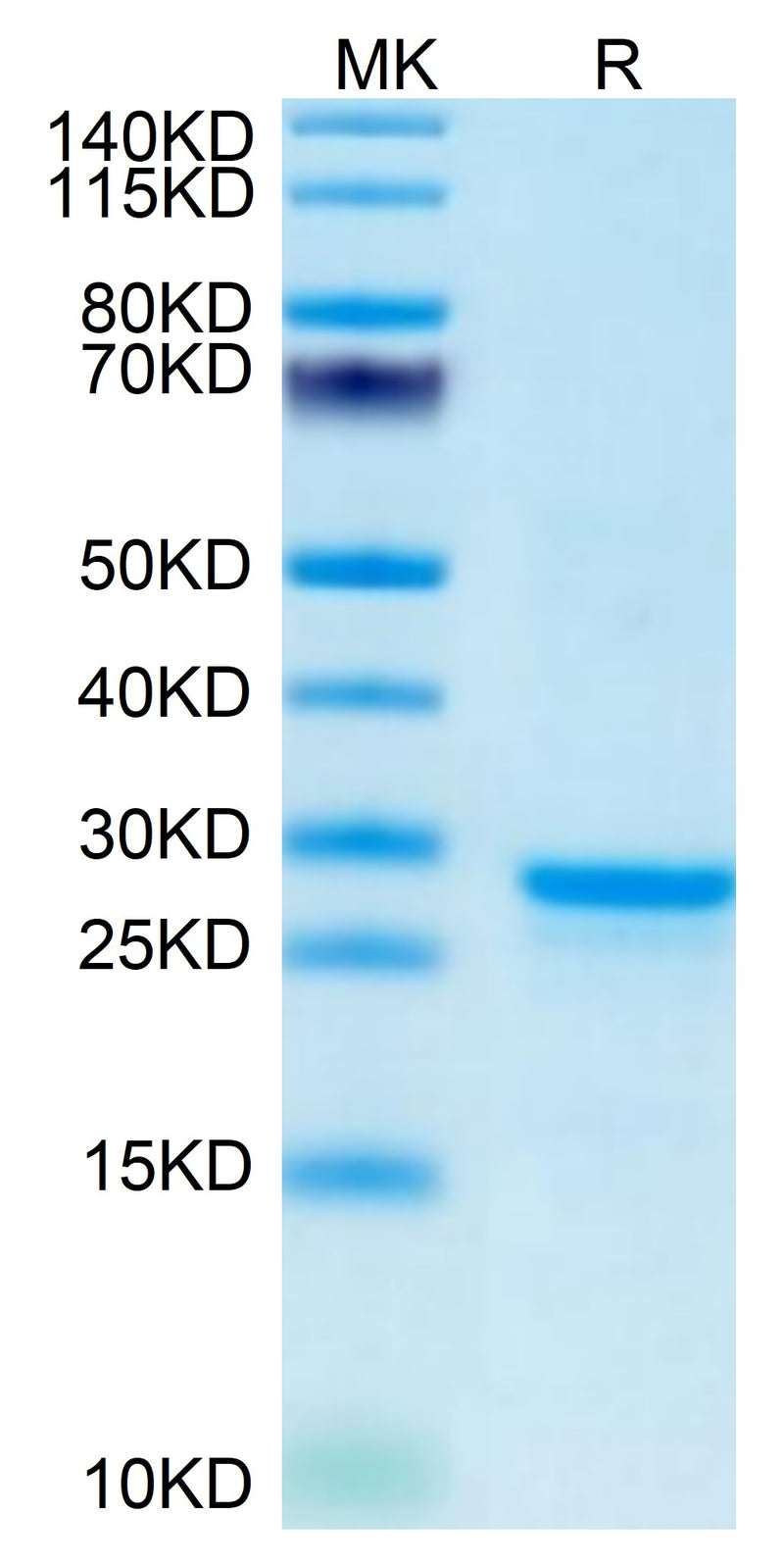 Mouse PS20 on Tris-Bis PAGE under reduced condition. The purity is greater than 95%.Recombinant Mouse PS20 Protein